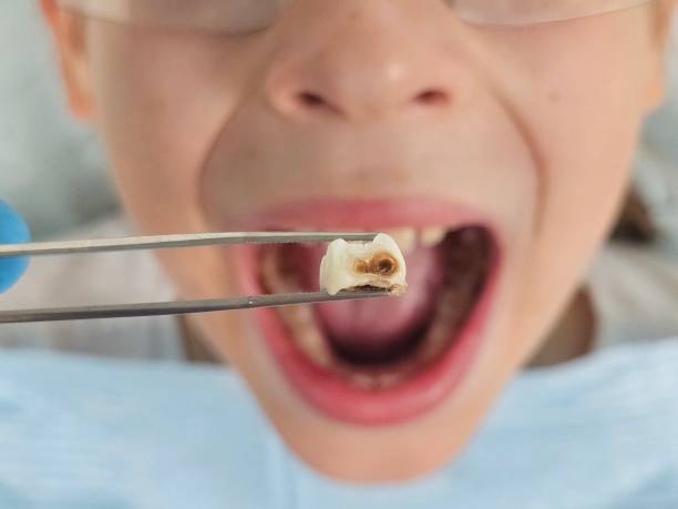 Best Emergency Dental Services for Seniors in Seabrook, MD