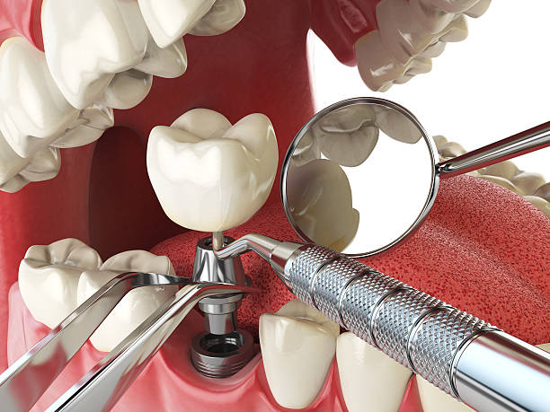 Best Emergency Dentist for Special Needs Patients in Seabrook, MD